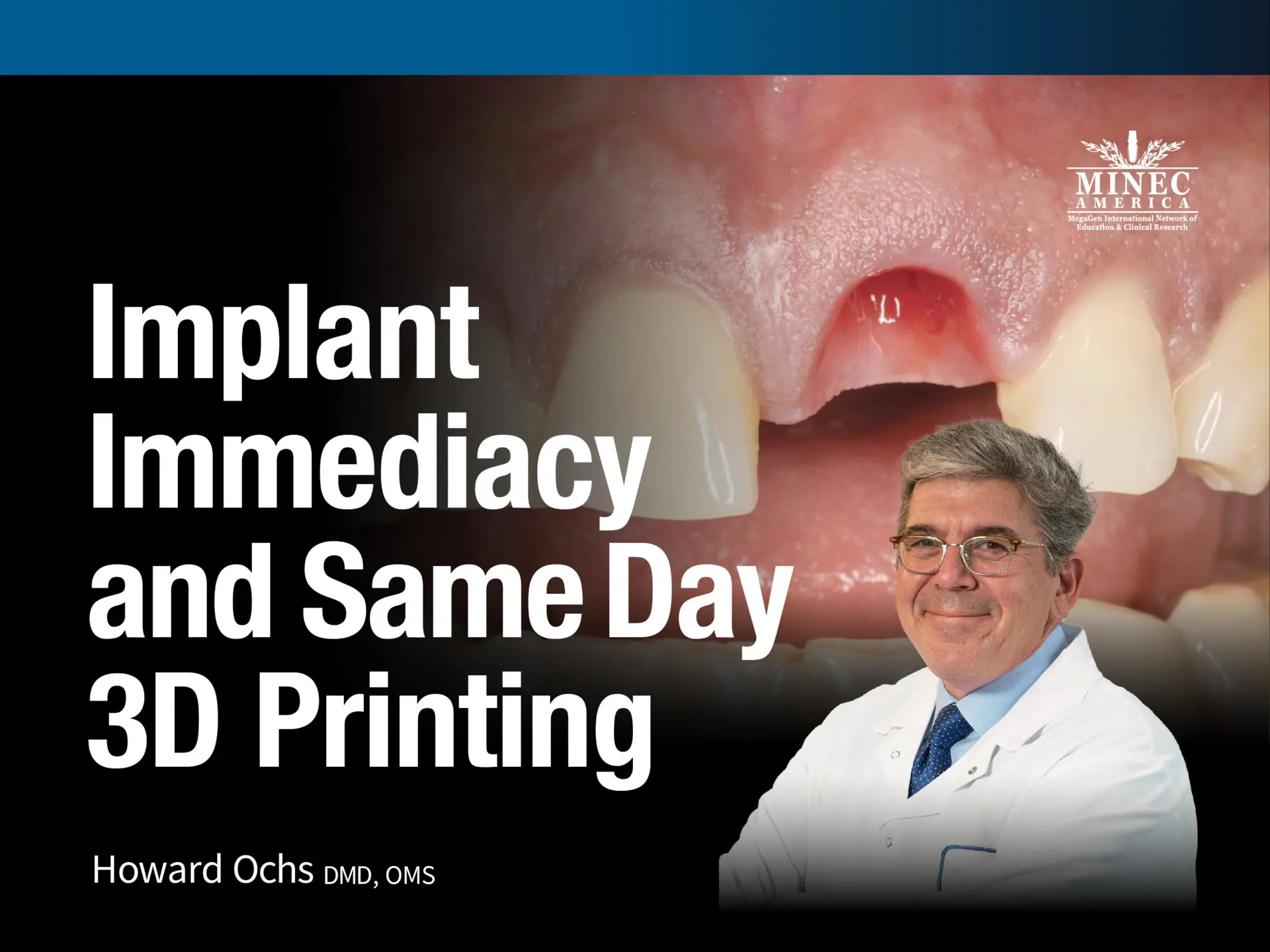 Implant Immediacy and Same Day 3D Printing